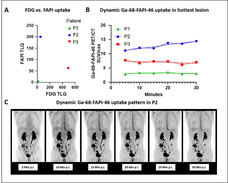 Quantitative Analysis of F-18-FDG-PET/CT and Ga-68-FAPI-46-PET/CT including dynamic analysis.